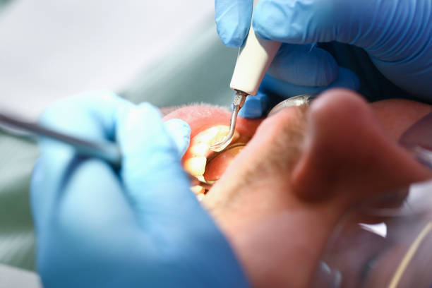 Best Pediatric Emergency Dentist in Wilson, AR