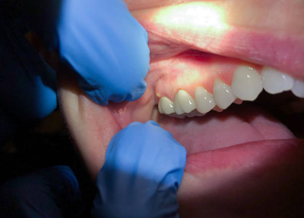 Best Emergency TMJ Treatment in Wilson, AR